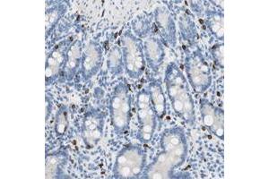 Immunohistochemical staining of human salivary gland with CEACAM3 polyclonal antibody  shows moderate membranous positivity in glandular cells. (CEACAM1 Antikörper)