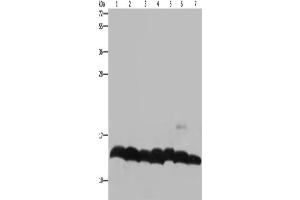 Western Blotting (WB) image for anti-Histone H4 antibody (ABIN2423581) (Histone H4 Antikörper)
