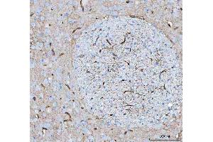 IHC analysis of Aquaporin 4 using anti-Aquaporin 4 antibody (ABIN3043789).