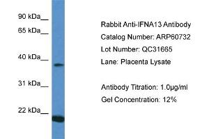 Western Blotting (WB) image for anti-Interferon, alpha 13 (IFNA13) (C-Term) antibody (ABIN2788553) (IFNA13 Antikörper  (C-Term))