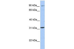 WB Suggested Anti-ELFN2 Antibody Titration:  0. (ELFN2 Antikörper  (N-Term))