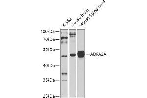 Western blot analysis of extracts of various cell lines, using A antibody (ABIN3016751, ABIN3016752, ABIN3016753 and ABIN6219833) at 1:1000 dilution. (ADRA2A Antikörper  (AA 240-380))