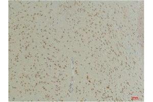Immunohistochemical analysis of paraffin-embedded Mouse BrainTissue using GABA Transporter 1 Rabbit pAb diluted at 1:200. (SLC6A1 Antikörper)