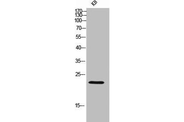 IGLL1 Antikörper  (C-Term)