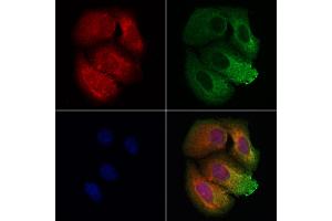 ABIN7093832 and ABIN7097875 staining Hela cells by IF/ICC.
