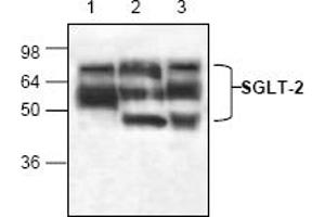 Image no. 1 for anti-Solute Carrier Family 5 (Sodium/glucose Cotransporter), Member 2 (SLC5A2) (N-Term) antibody (ABIN155150) (SLC5A2 Antikörper  (N-Term))