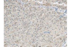 IHC-P analysis of Human Liver Tissue, with DAB staining. (CRP Antikörper  (AA 17-224))