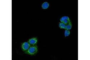IF analysis of USP21 using anti-USP21 antibody (ABIN7601053). (USP21 Antikörper  (AA 277-565))
