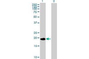Western Blot analysis of NME6 expression in transfected 293T cell line by NME6 MaxPab polyclonal antibody. (NME6 Antikörper  (AA 1-194))