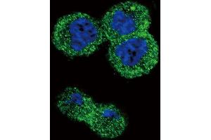 Confocal immunofluorescent analysis of AKT1 Antibody (N-term) h with MDA-M cell followed by Alexa Fluor 488-conjugated goat anti-rabbit lgG (green). (AKT1 Antikörper  (N-Term))