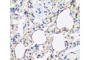 Immunohistochemistry of paraffin-embedded Rat lung using ALOX15 Polyclonal Antibody at dilution of 1:200 (40x lens). (ALOX15 Antikörper)