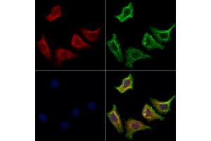 ABIN6263575 and ABIN6273145 staining Hela cells by IF/ICC.