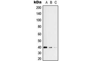Western blot analysis of RFC3 expression in HeLa (A), HEK293 (B), Jurkat (C) whole cell lysates. (RFC3 Antikörper  (Center))