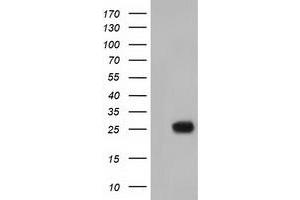 HEK293T cells were transfected with the pCMV6-ENTRY control (Left lane) or pCMV6-ENTRY MOBKL2B (Right lane) cDNA for 48 hrs and lysed. (MOBKL2B Antikörper)