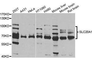 Western blot analysis of extracts of various cells, using SLC20A1 antibody. (SLC20A1 Antikörper)