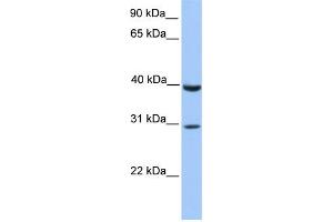 WB Suggested Anti-JAZF1 Antibody Titration:  0. (JAZF1 Antikörper  (C-Term))