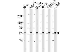 All lanes : Anti-NDC80 Antibody (C-Term) at 1:2000 dilution Lane 1: Hela whole cell lysate Lane 2: MCF-7 whole cell lysate Lane 3: U-2OS whole cell lysate Lane 4: K562 whole cell lysate Lane 5: 293T/17 whole cell lysate Lane 6: Jurkat whole cell lysate Lysates/proteins at 20 μg per lane. (NDC80 Antikörper  (AA 594-628))