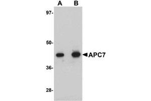 Western blot analysis of APC7 in rat kidney tissue lysate with AP30063PU-N APC7 antibody at (A) 1 and (B) 2 μg/ml. (ANAPC7 Antikörper  (C-Term))