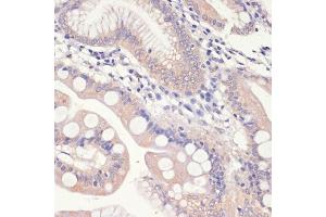 Immunohistochemistry of paraffin-embedded human small intestine using HMGCR antibody (ABIN3022293, ABIN3022294, ABIN3022295, ABIN1513022 and ABIN6218714) at dilution of 1:200 (40x lens). (HMGCR Antikörper  (AA 629-888))