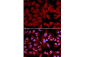 Immunofluorescence analysis of U2OS cells using PSMA4 antibody (ABIN5971344). (PSMA4 Antikörper)