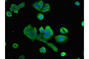Immunofluorescent analysis of HepG2 cells using ABIN7162750 at dilution of 1:100 and Alexa Fluor 488-congugated AffiniPure Goat Anti-Rabbit IgG(H+L) (PTX3 Antikörper  (AA 99-164))