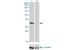 Western blot analysis of HDAC7A over-expressed 293 cell line, cotransfected with HDAC7A Validated Chimera RNAi (Lane 2) or non-transfected control (Lane 1). (HDAC7 Antikörper  (AA 1-276))