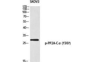 Western Blot (WB) analysis of SKOV3 using p-PP2A-Calpha (Y307) antibody. (PPP2CA Antikörper  (pTyr307))