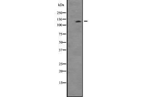 Western blot analysis of TTBK2 expression in Mouse thymus lysate ;,The lane on the left is treated with the antigen-specific peptide. (TTBK2 Antikörper  (C-Term))