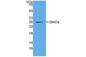 Detection of Recombinant CX43, Human using Polyclonal Antibody to Connexin 43 (CX43) (Connexin 43/GJA1 Antikörper  (AA 244-382))