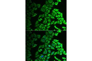 Immunofluorescence analysis of A549 cells using IL18BP antibody (ABIN5973845). (IL18BP Antikörper)