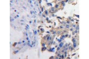Used in DAB staining on fromalin fixed paraffin-embedded ovary tissue (PDGFD Antikörper  (AA 19-370))