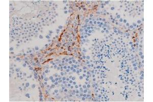 ABIN6267471 at 1/200 staining Mouse testis tissue sections by IHC-P.