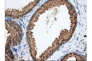 Immunohistochemical staining of paraffin-embedded Human pancreas tissue using anti-PDE4A mouse monoclonal antibody. (PDE4A Antikörper)
