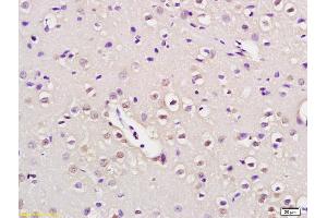 Formalin-fixed and paraffin embedded rat brain labeled with Anti-NUP50 Polyclonal Antibody, Unconjugated (ABIN873330) at 1:200 followed by conjugation to the secondary antibody and DAB staining