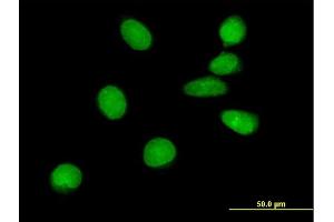 Immunofluorescence of purified MaxPab antibody to ASCIZ on HeLa cell. (ATM Interactor Antikörper  (AA 1-667))