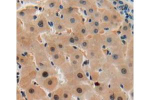 IHC-P analysis of liver tissue, with DAB staining. (SGK2 Antikörper  (AA 40-311))
