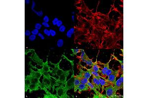 Immunocytochemistry/Immunofluorescence analysis using Mouse Anti-SUR2A Monoclonal Antibody, Clone S319A-14 . (ABCC9 Antikörper  (AA 1505-1546) (FITC))