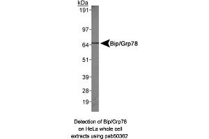 Image no. 1 for anti-Heat Shock 70kDa Protein 5 (Glucose-Regulated Protein, 78kDa) (HSPA5) (AA 250-300), (Internal Region) antibody (ABIN363671) (GRP78 Antikörper  (Internal Region))