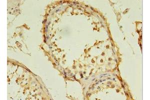 Immunohistochemistry of paraffin-embedded human testis tissue using ABIN7171830 at dilution of 1:100 (TSGA13 Antikörper  (AA 1-275))