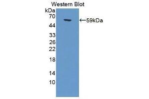 Western blot analysis of the recombinant protein. (Calpain 6 Antikörper  (AA 26-495))