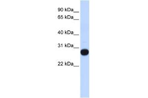WB Suggested Anti-TCEAL4 Antibody Titration:  0. (TCEAL4 Antikörper  (Middle Region))