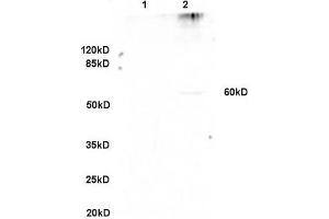 Formalin-fixed and paraffin embedded rat lung labeled with Anti-GPNMB/Osteoactivin Polyclonal Antibody, Unconjugated (ABIN749093) at 1:200 followed by conjugation to the secondary antibody and DAB staining. (Osteoactivin Antikörper  (AA 81-180))
