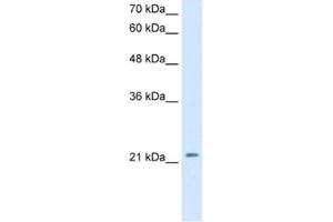 Western Blotting (WB) image for anti-Dickkopf Homolog 1 (DKK1) antibody (ABIN2463124) (DKK1 Antikörper)