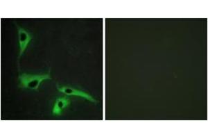 Immunofluorescence analysis of HeLa cells, using TSPAN8 Antibody.