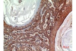 Immunohistochemistry (IHC) image for anti-Inhibin, beta B (INHBB) (C-Term) antibody (ABIN3187910)