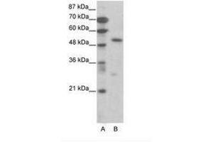 Image no. 1 for anti-Transcription Factor 7 (T-Cell Specific, HMG-Box) (TCF7) (AA 391-440) antibody (ABIN6736068) (TCF7 Antikörper  (AA 391-440))