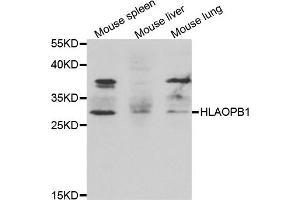 Western blot analysis of extracts of various cell lines, using HLA-DPB1 antibody. (HLA-DPB1 Antikörper)
