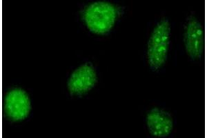 Immunofluorescence of purified MaxPab antibody to TAF12 on HeLa cell. (TAF12 Antikörper  (AA 1-161))