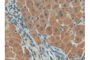 Detection of PDGF BB in Human Liver Tissue using Polyclonal Antibody to Platelet Derived Growth Factor BB (PDGF BB) (PDGF-BB Homodimer (AA 82-190) Antikörper)