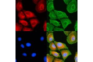 ABIN6258236 and ABIN6274733 staining  cells(UV treatment) by IF/ICC. (MRPL18 Antikörper  (Internal Region))